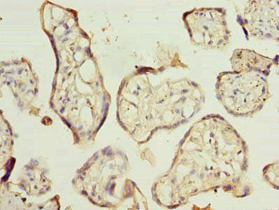 RNF138 Antibody