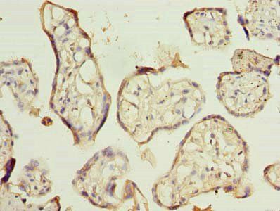 RNF138 antibody