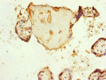 RNF139 Antibody