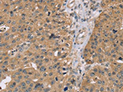 RNF139 Antibody