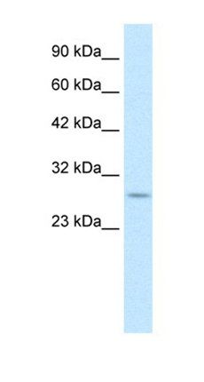 RNF141 antibody
