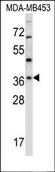 RNF144A antibody