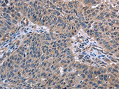 RNF144B Antibody