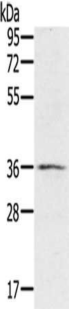 RNF144B antibody