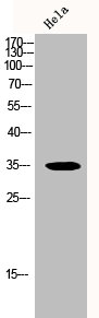 RNF144B antibody