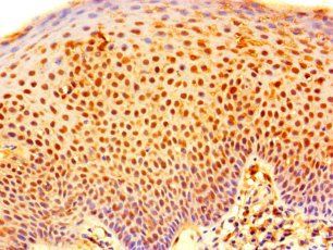 RNF182 Antibody