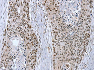 RNF20 antibody