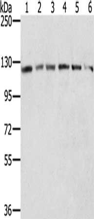 RNF20 antibody