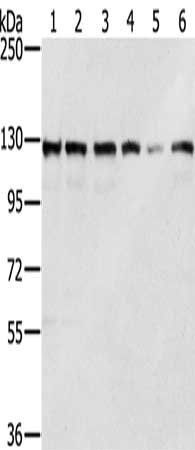 RNF20 antibody