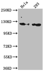 RNF20 Recombinant Monoclonal Antibody