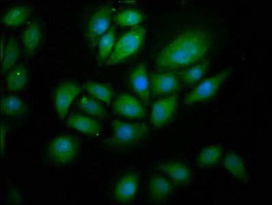 RNF213 Antibody