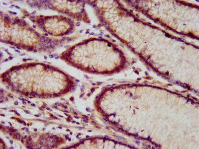 RNF213 Antibody