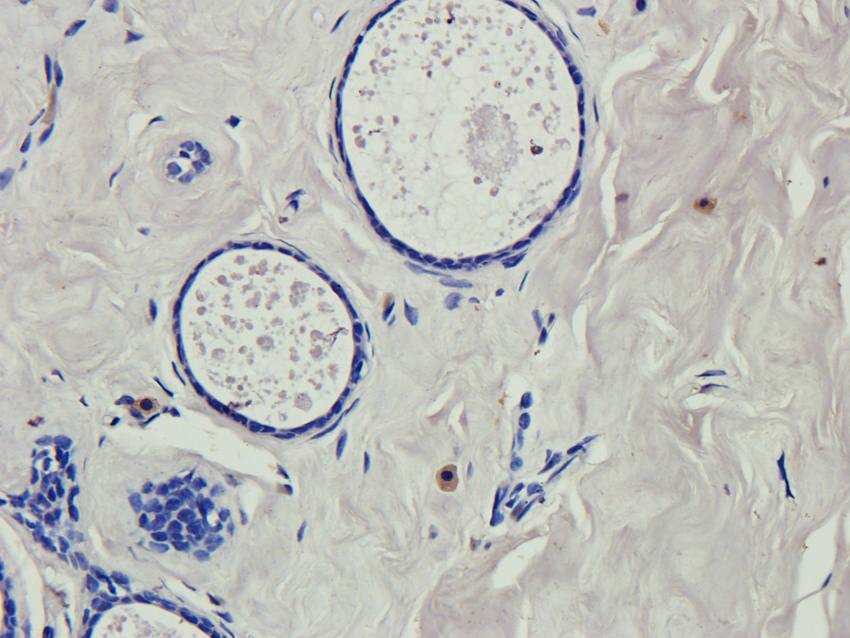 RNF4 antibody