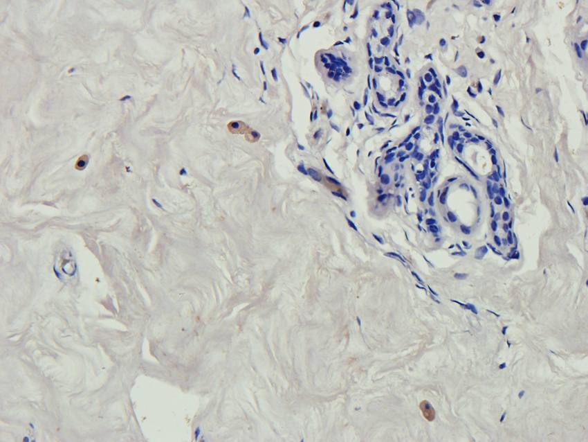 RNF4 antibody