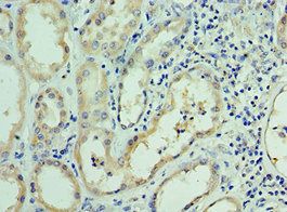 RNLS Antibody