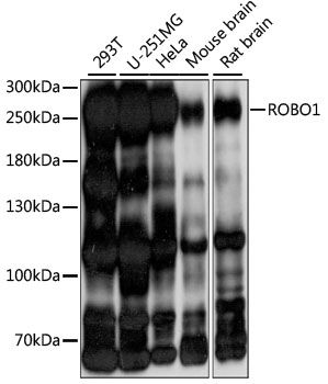 ROBO1 antibody