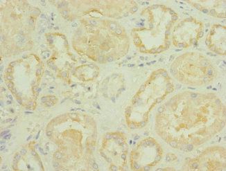 ROBO2 Antibody