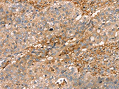 ROBO3 Antibody