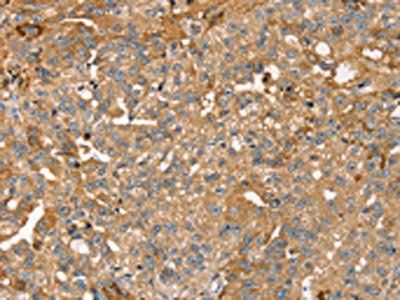 ROBO3 Antibody