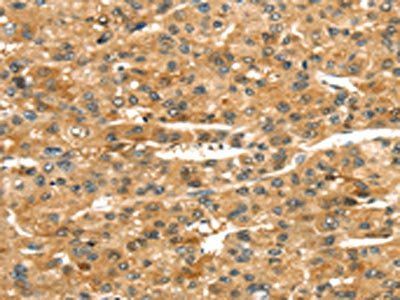 ROBO4 Antibody