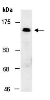 ROBO4 (M) Antibody, Rabbit Polyclonal