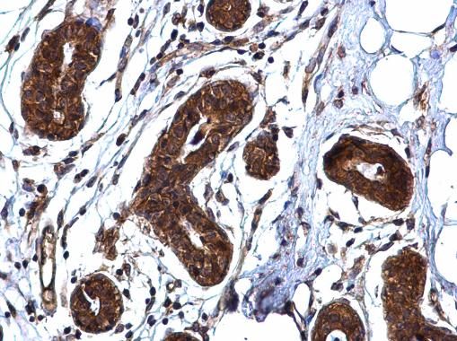 ROCK1 antibody [N1N2], N-term