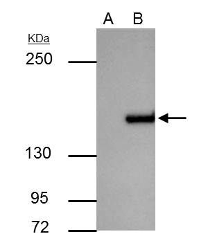 ROCK1 antibody