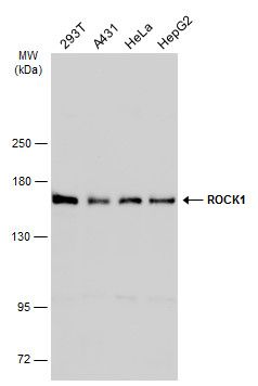 ROCK1 antibody [N1N2], N-term