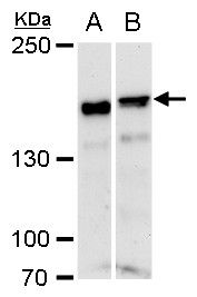 ROCK1 antibody [N1N2], N-term