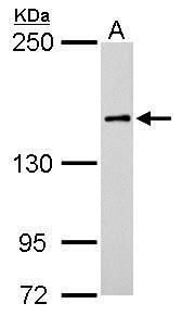 ROCK1 antibody