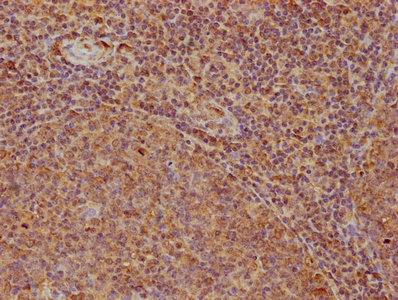 ROCK1 antibody