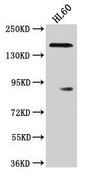 ROCK1 Antibody