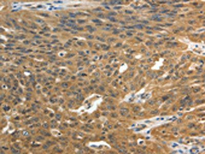 ROCK2 Antibody