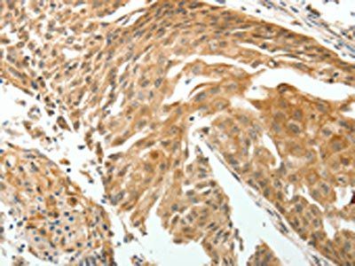 ROCK2 Antibody