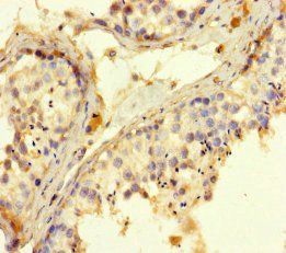 ROPN1 Antibody