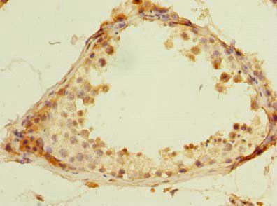 ROPN1L antibody