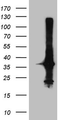 ROR beta Antibody