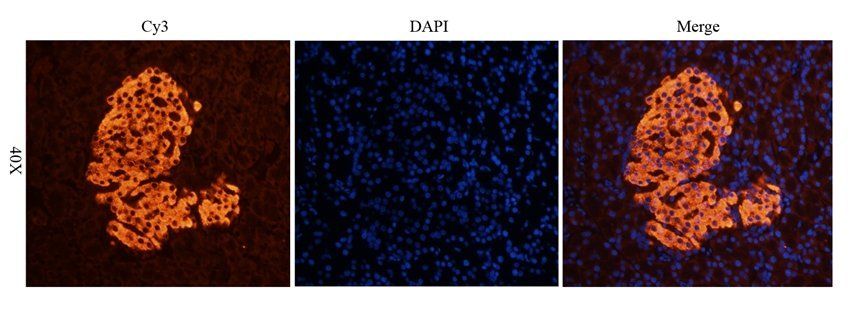 ROR gamma T antibody