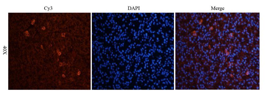 ROR gamma T antibody