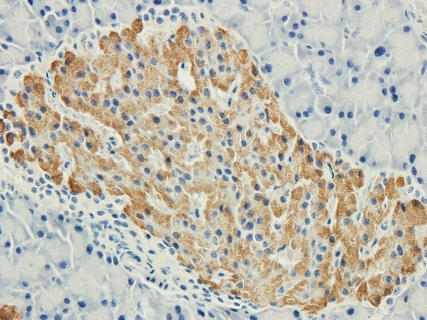 ROR gamma T antibody