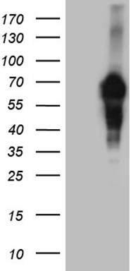 ROR1 Antibody