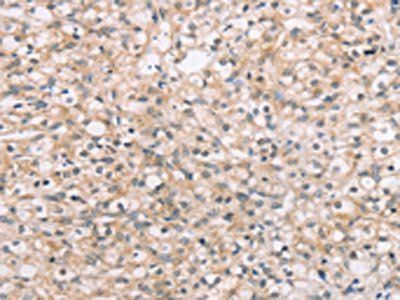ROR1 Antibody