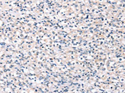 ROR1 Antibody