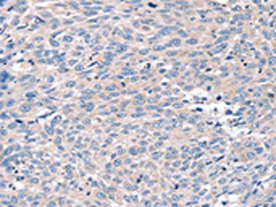 ROR1 Antibody