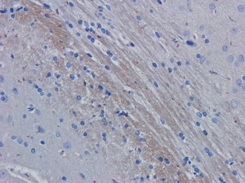 ROR1 antibody