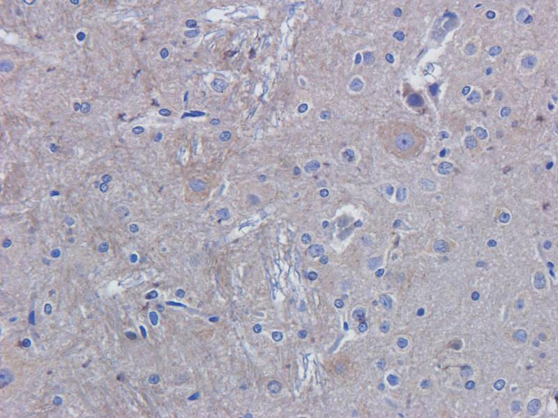 ROR1 antibody