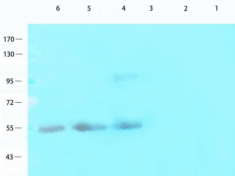 ROR1 antibody