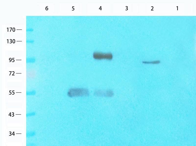 ROR1 antibody