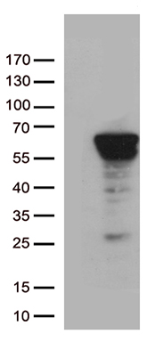 ROR2 Antibody