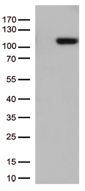 ROR2 Antibody